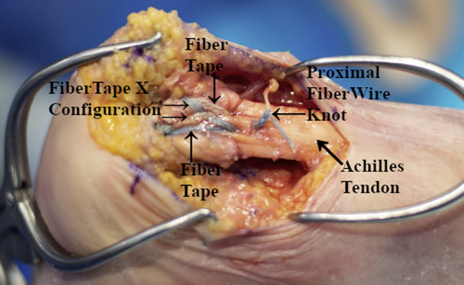 Fig 10