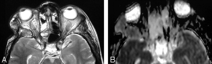 Fig 5.