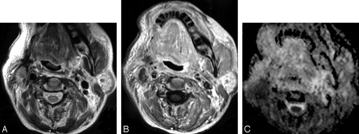 Fig 2.