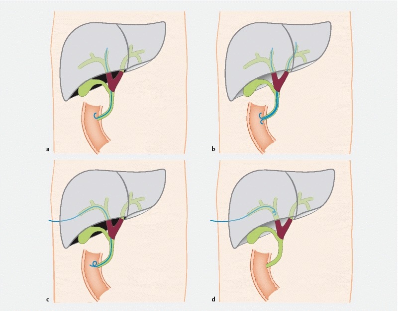 Fig. 2