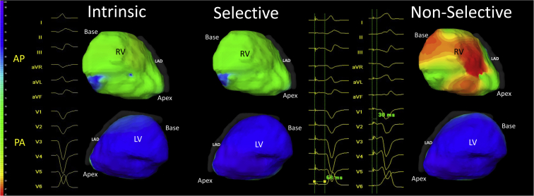 Figure 3