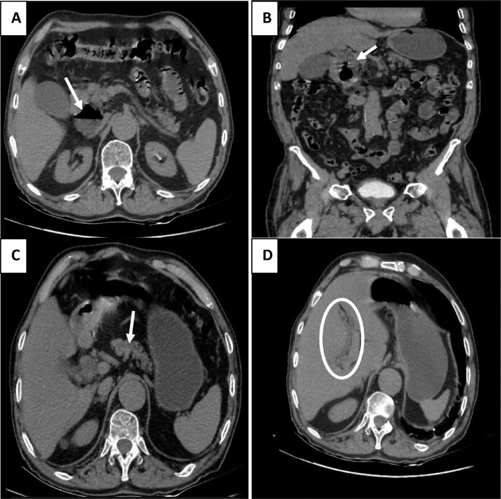 Fig 1