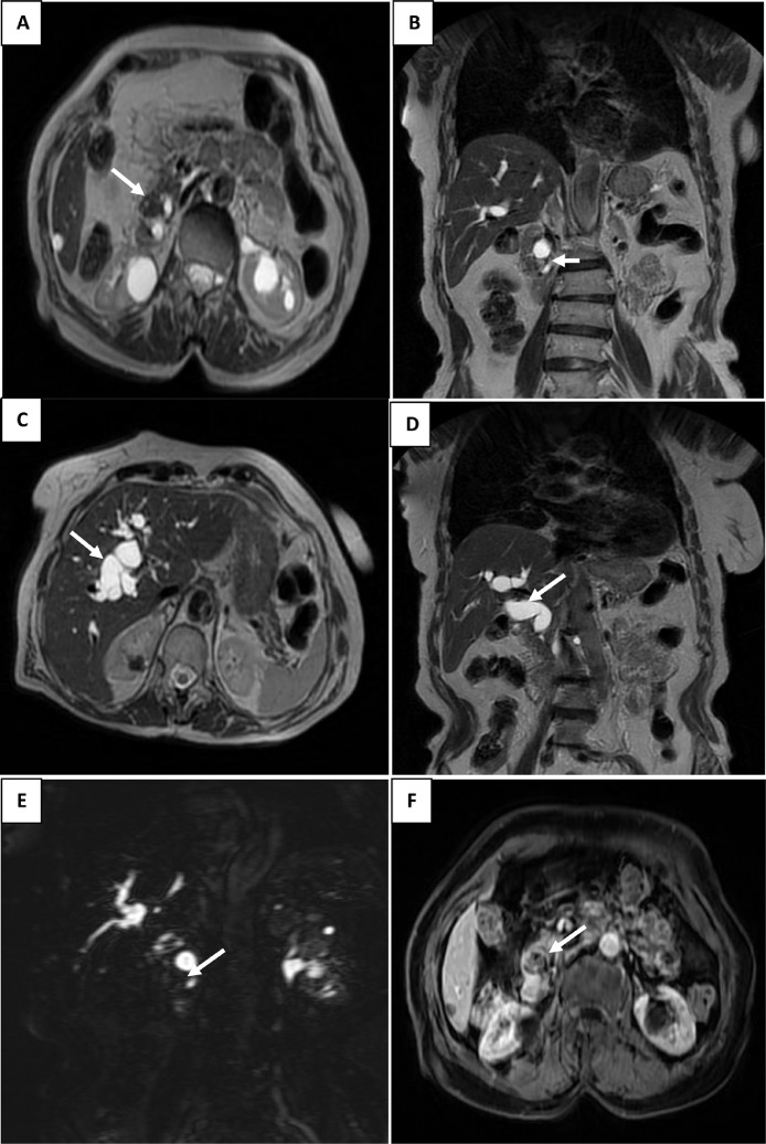 Fig 3