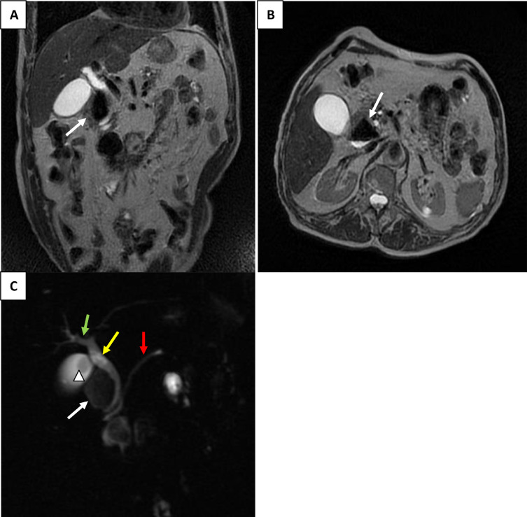 Fig 2