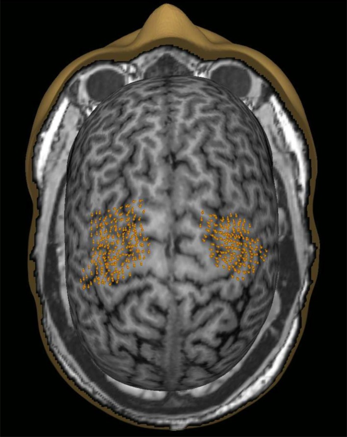 Fig. (1)