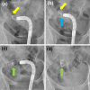 Fig. 4