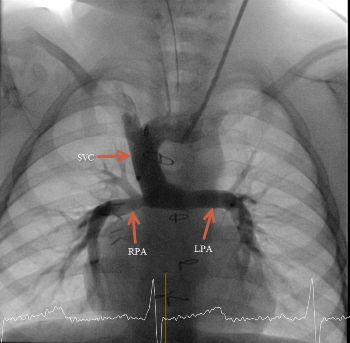 Fig. (1)