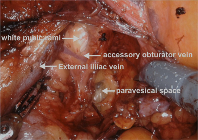 Fig. 12
