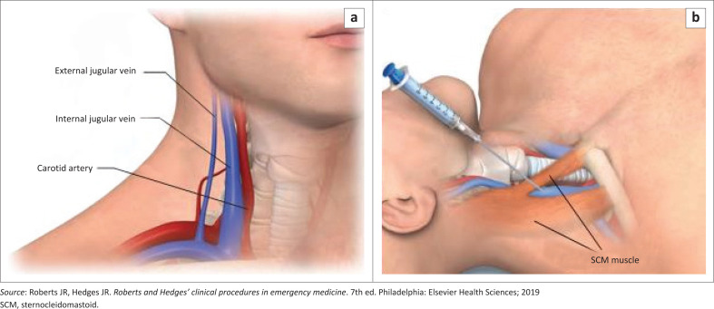 FIGURE 1