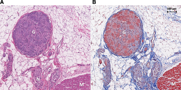 Figure 5: