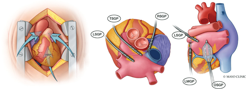 Figure 1: