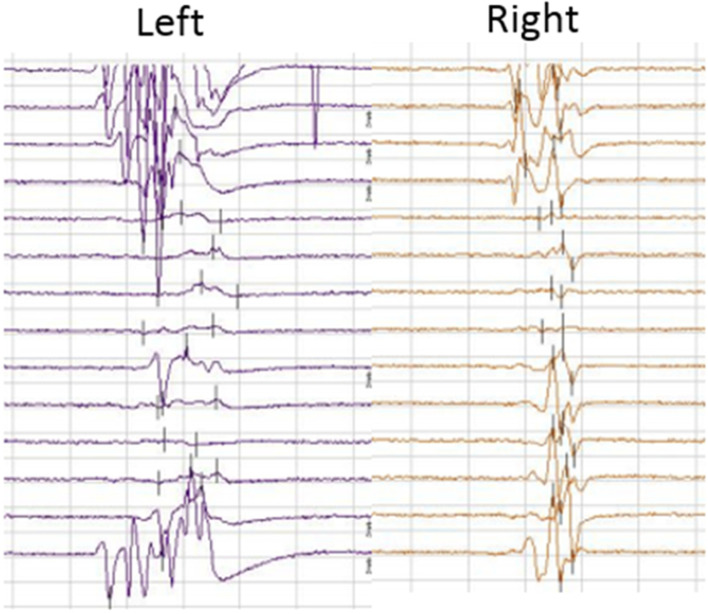 Fig. 4