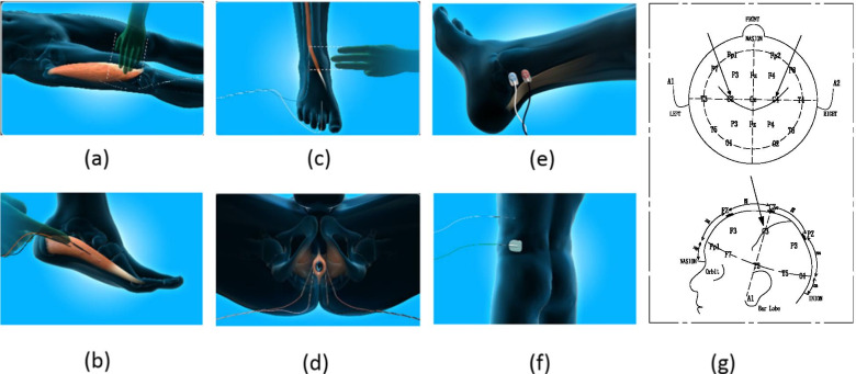 Fig. 2