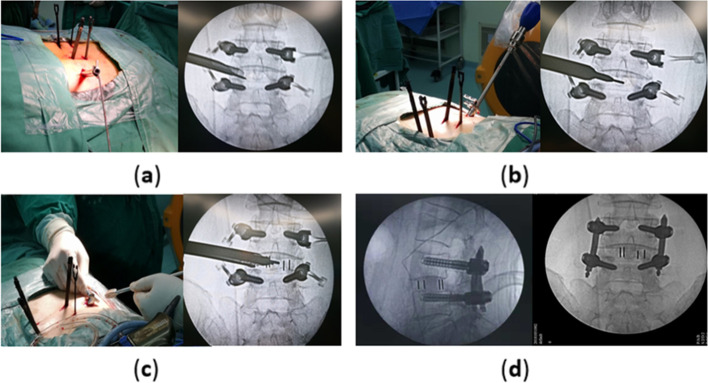 Fig. 3