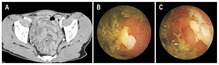 Fig. 4