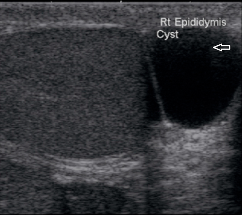 Fig. 13