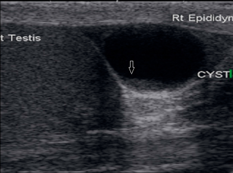 Fig. 14