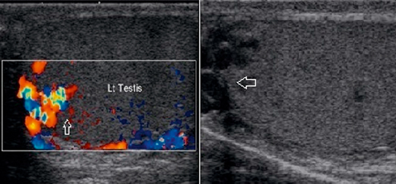 Fig. 11