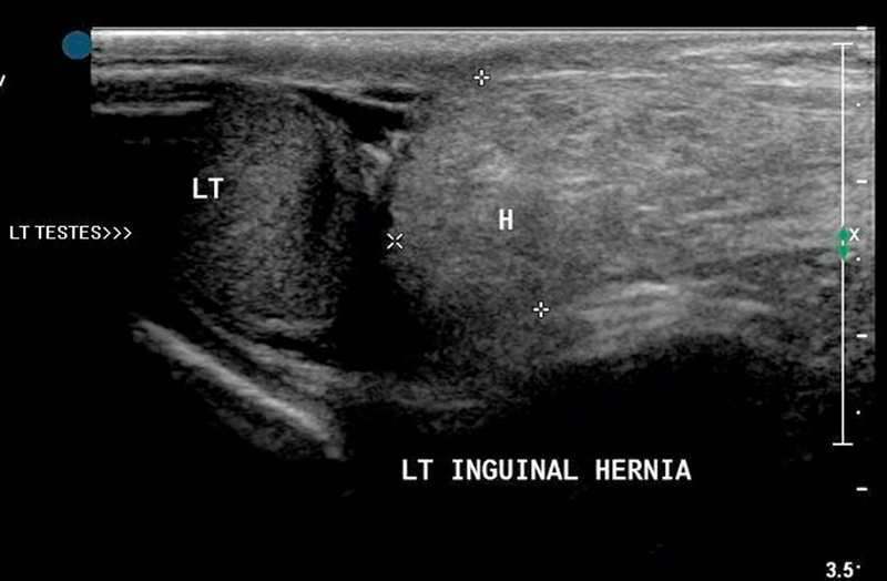 Fig. 16