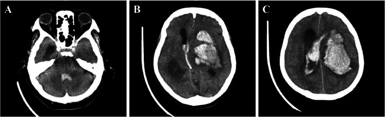 Fig 1