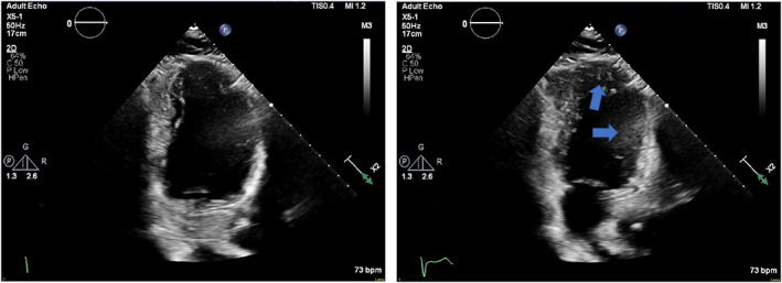 FIGURE 4