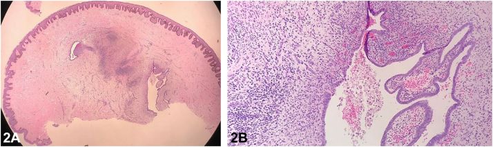Fig 2