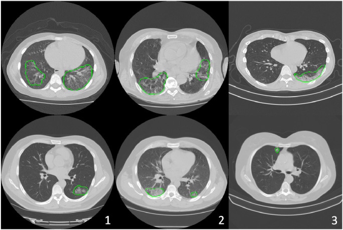 Fig. 2