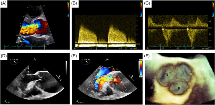 FIGURE 1