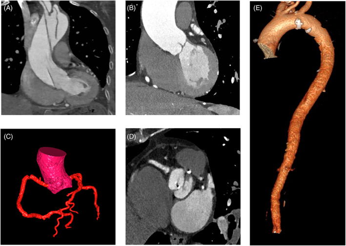 FIGURE 3