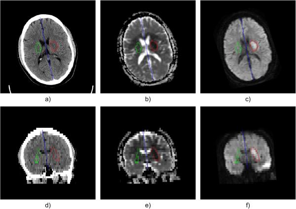 Fig. 3