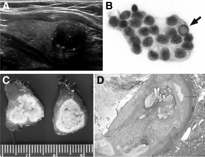 FIG. 1.