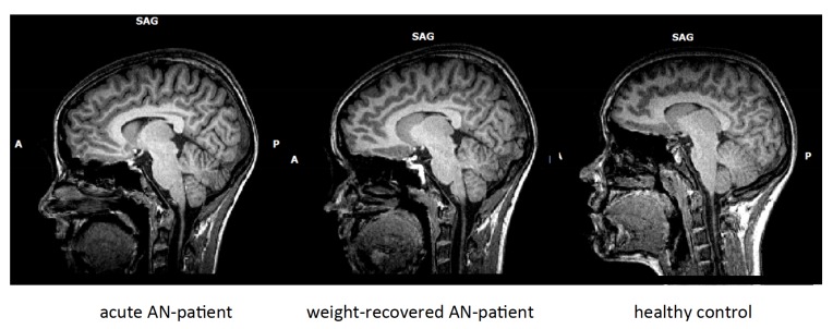 Fig. (1)