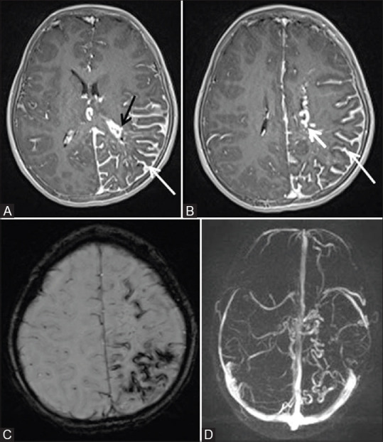 Figure 17 (A-D)