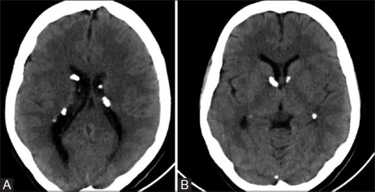 Figure 12 (A and B)