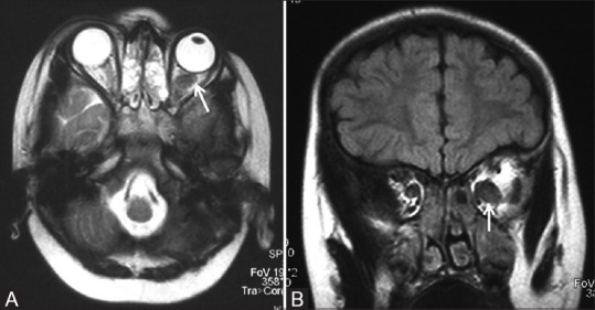 Figure 1 (A and B)