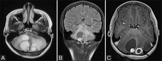 Figure 18 (A-C)