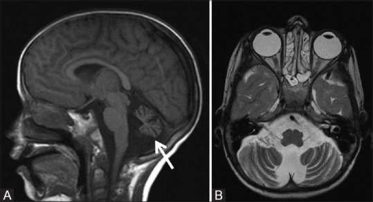 Figure 21 (A and B)