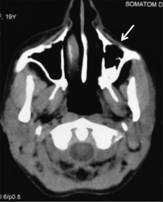 Figure 24