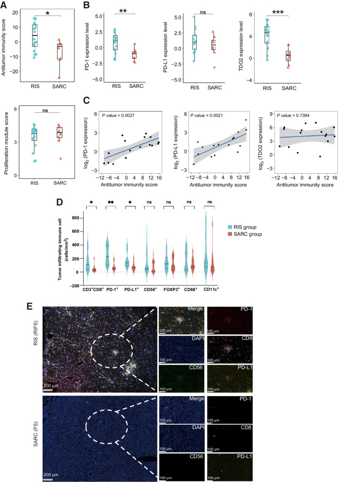 Figure 2. The antitumor immunity of RIS. A, The antitumor immunity score (top) and the proliferation module score (bottom) of the RIS group and the SARC group. Box plot: the line inside the box indicates median, the top and the bottom borders of the box indicate upper and lower quartile. B, Expression levels of PD-1, PD-L1, and TDO2 in the RIS group and the SARC group in box plots. C, Correlations between expression levels of PD-1, PD-L1, and TDO2 and the antitumor immunity score in RIS. D, The summary of the density of tumor-infiltrating immune cells (cells/mm2) by mIF in the RIS group and the SARC group (15 specimens in each group). Solid lines indicate median and dotted lines indicate quartiles. E, Representative images of mIF staining showing immune infiltration in an RIS and a primary sarcoma. ***, P < 0.001; **, P < 0.01; *, P < 0.05.