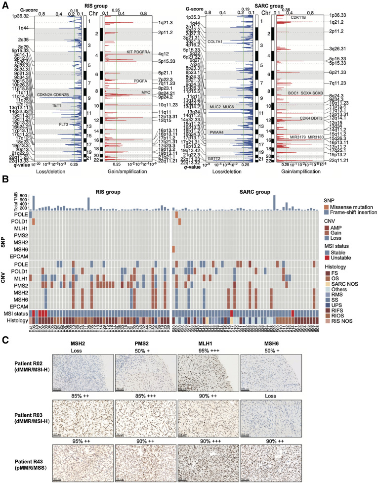 Figure 4. Genome instability and mutational signatures of RIS and primary sarcomas. A, Copy-number analysis of the RIS group and the SARC group. B, Bars showing TMB (top), heat maps summarizing alterations of POLE, POLD1, MLH1, PMS2, MSH2, MSH6, and EPCAM (middle) and predicted MSI status (bottom) in two groups. C, Representative images of IHC staining for MMR proteins in two MMR-deficient (dMMR)/MSI-H RIS and one MMR-proficient (pMMR)/MSS RIS.