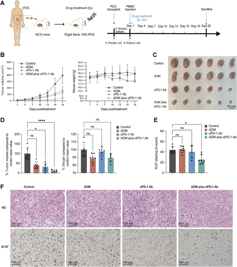 Figure 5. The RIS PDX mouse model responds better to the combination of anti–PD-1 antibody and chemotherapy than to chemotherapy alone. A, Diagrams for the establishment of the PDX mouse model and for the treatment and analysis of the model. B, The curves for tumor growth and mouse weight. C, Images of tumors at the end of the indicated treatment. D, Endpoint tumor volume and mouse weight. E and F, Quantification of Ki-67 (E) and representative images of HE staining and IHC staining for Ki-67 (F) of tumors at the end of indicated treatments. Scale bar = 100 μm. ****, P < 0.0001; ***, P < 0.001; **, P < 0.01; *, P < 0.05; one-way ANOVA. Error bars indicate mean ± SD.