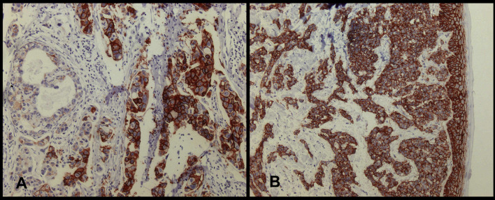 Fig. 1A, B