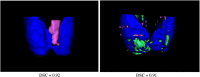 Fig. 13