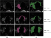 Fig. 11