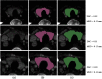 Fig. 10