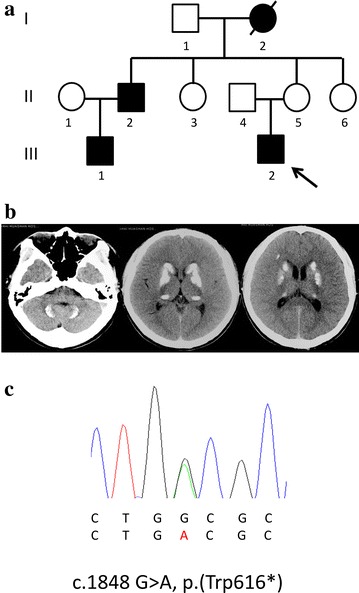 Fig. 1