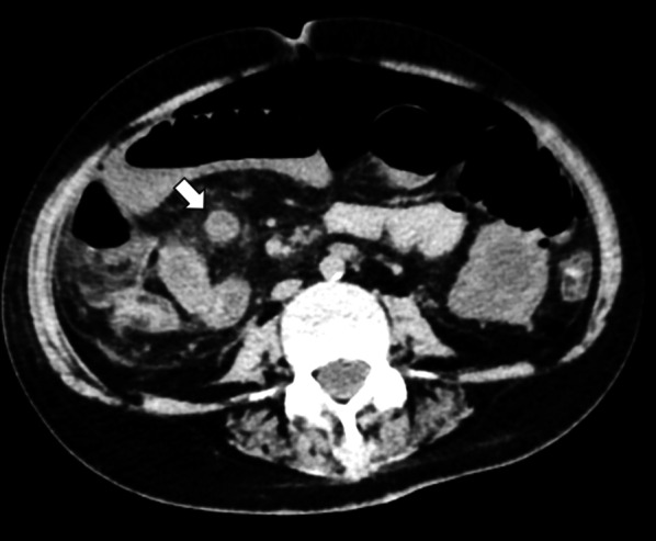 Fig. 1