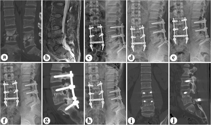 Fig. 1