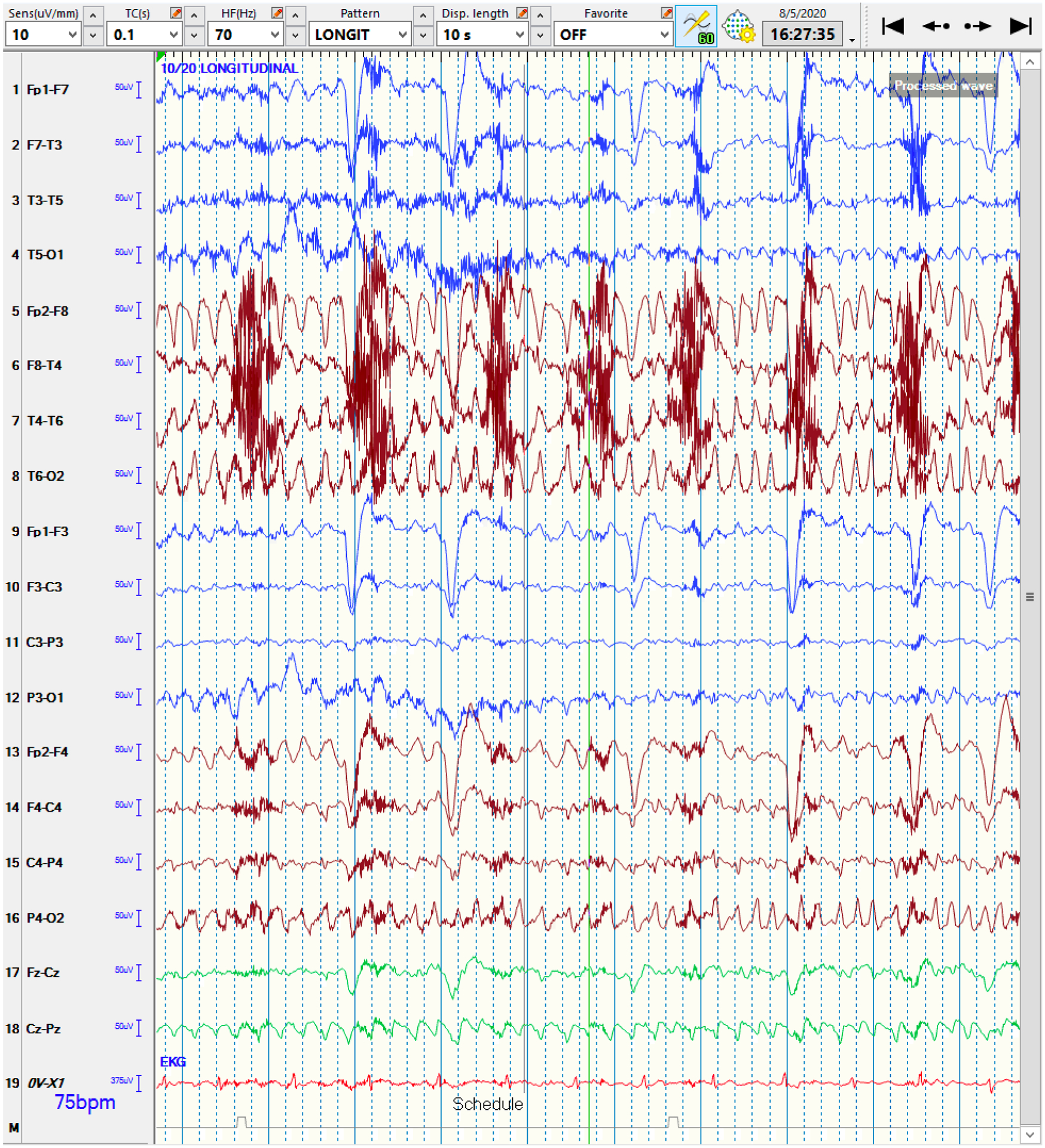 Figure 4: