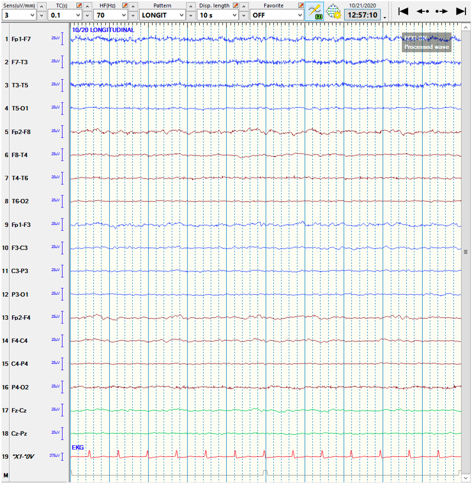 Figure 3: